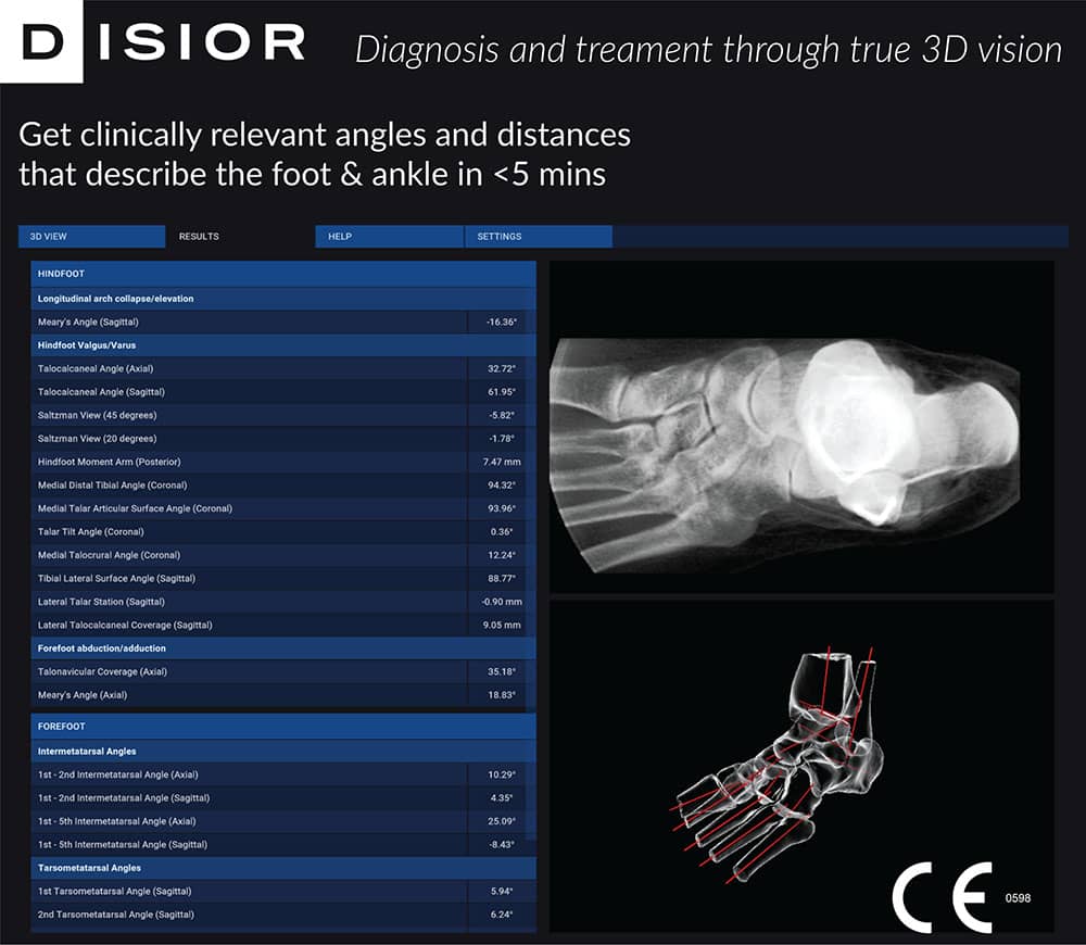 Ankle X ray and interpretation text