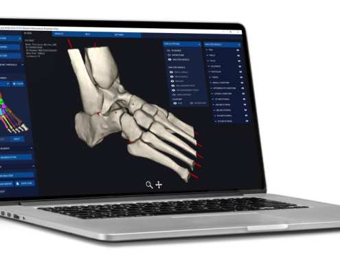 Disior foot software on a laptop
